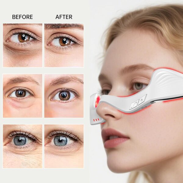 Tens Eye Beauty Massager with Led therapy